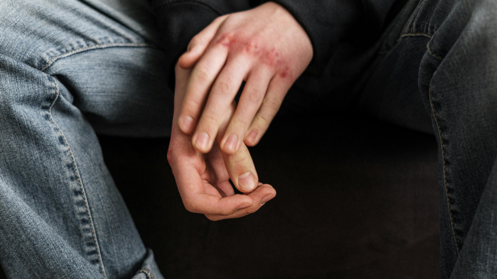 Vjolenza bejn studenti f’Għawdex: Każ serju ta’ aggressjoni jwassal għal proċeduri legali