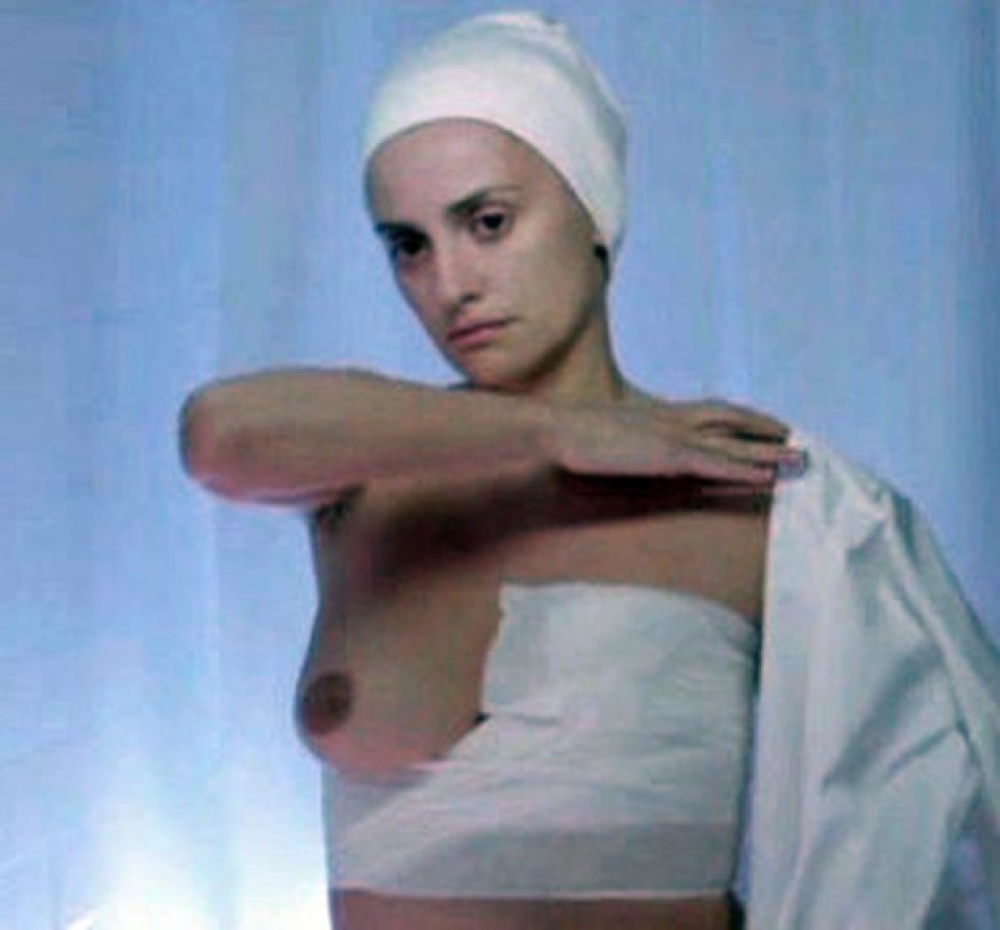 Penelope Cruz riedet tgħix fil-film dak li b'kuraġġ kbir jgħaddu dawk in-nisa ffaċċjati b'din il-marda