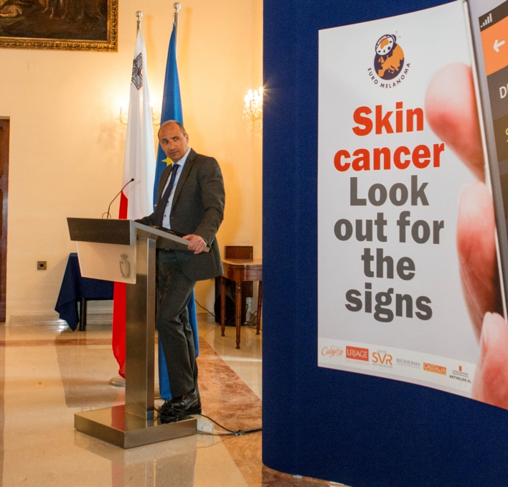 L-inċidenza ta’ melanoma qiegħda tiżdied