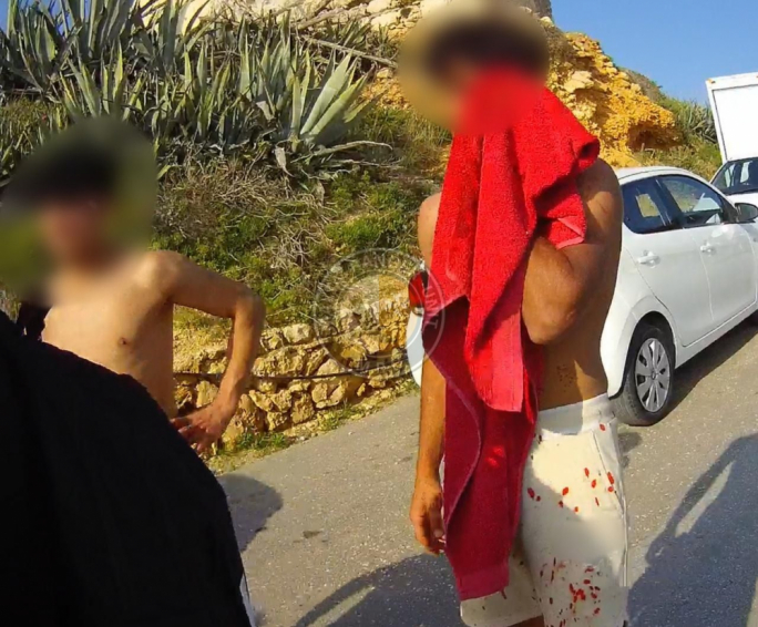 Ġlieda f’Golden Bay tħalli żagħżugħ bi ġrieħi gravi